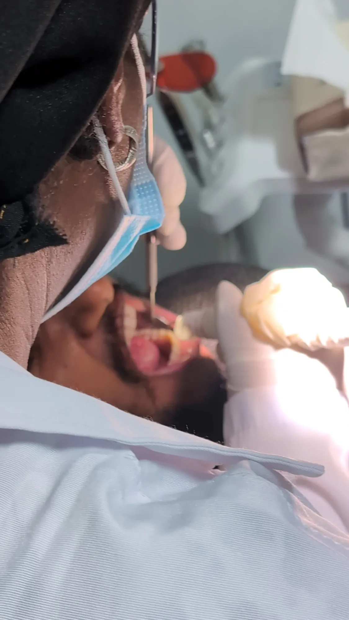 Teeth Whitening